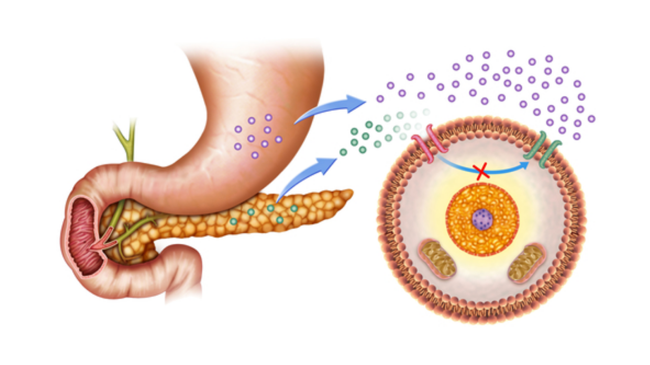 Diabetic ketoacidosis (DKA) emergency care in Hyderabad