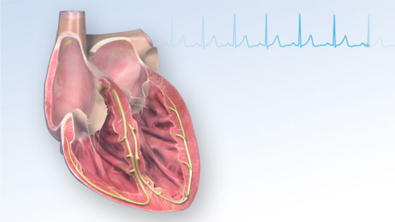 Arrhythmia irregular heartbeat evaluation in Hyderabad