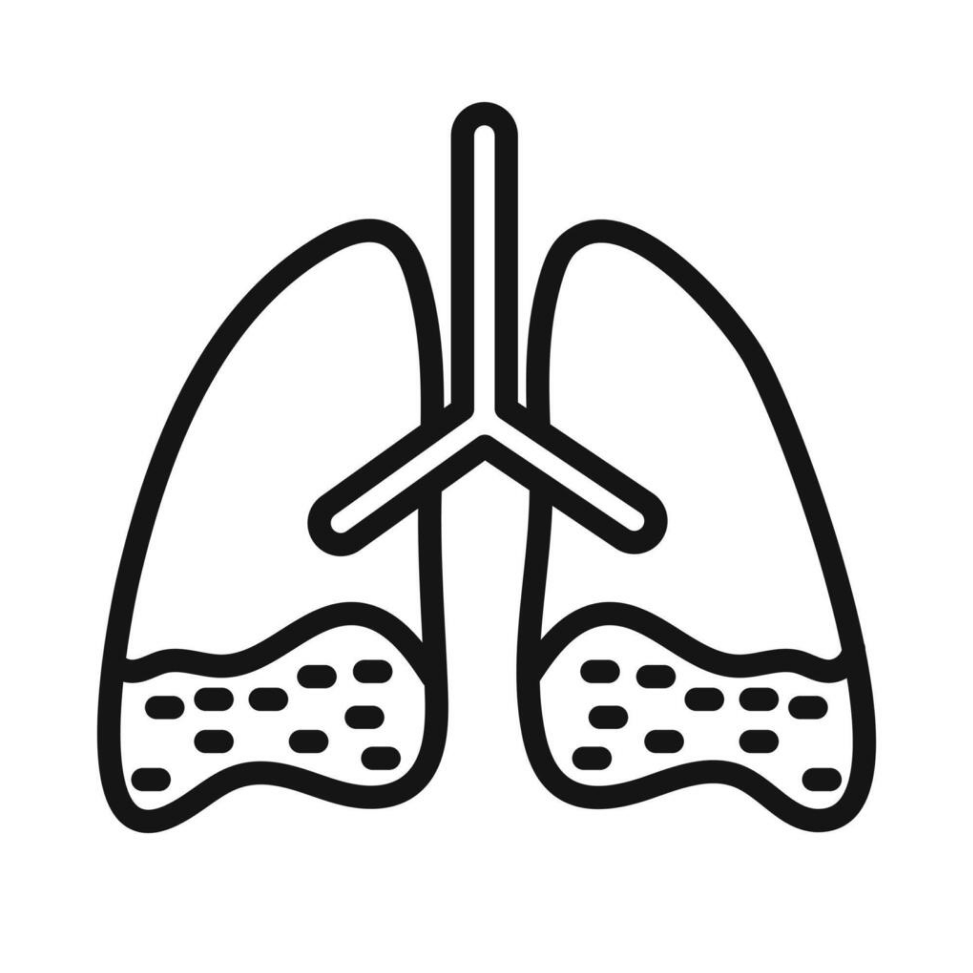 Asthma 