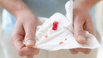 Bleeding disorders clotting workup in Hyderabad