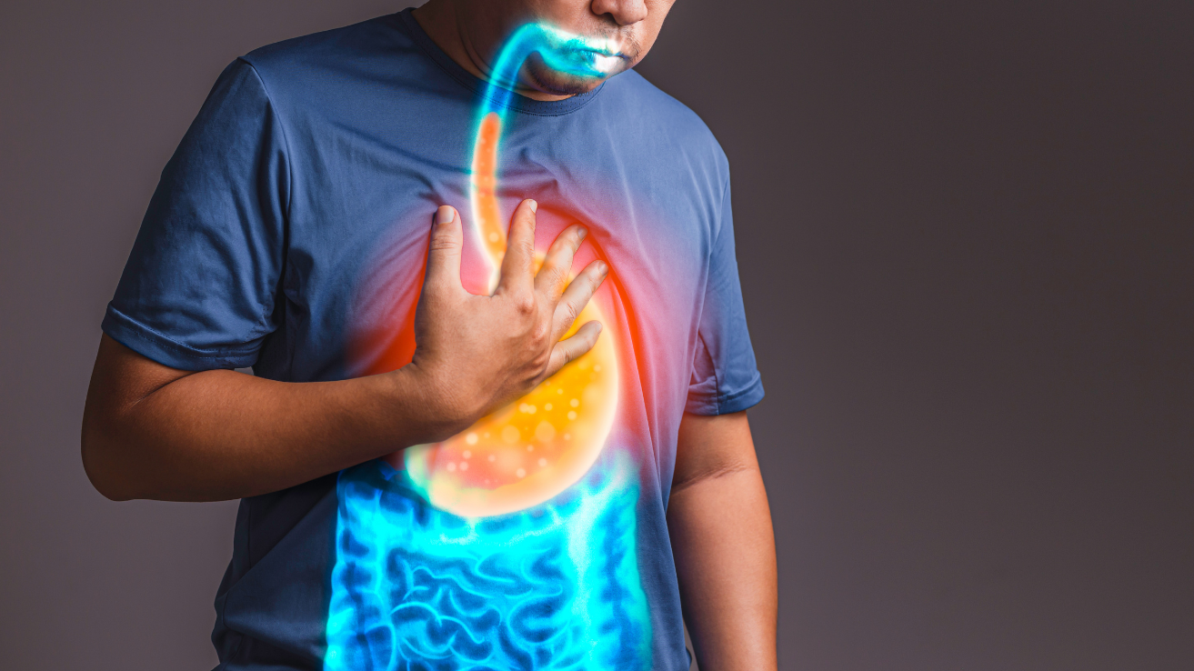GERD acid reflux and heartburn evaluation in Hyderabad