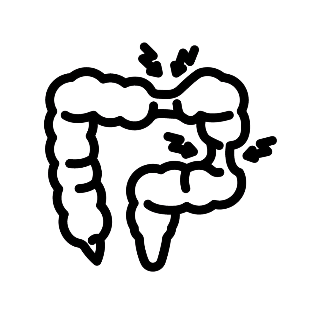Irritable Bowel Syndrome