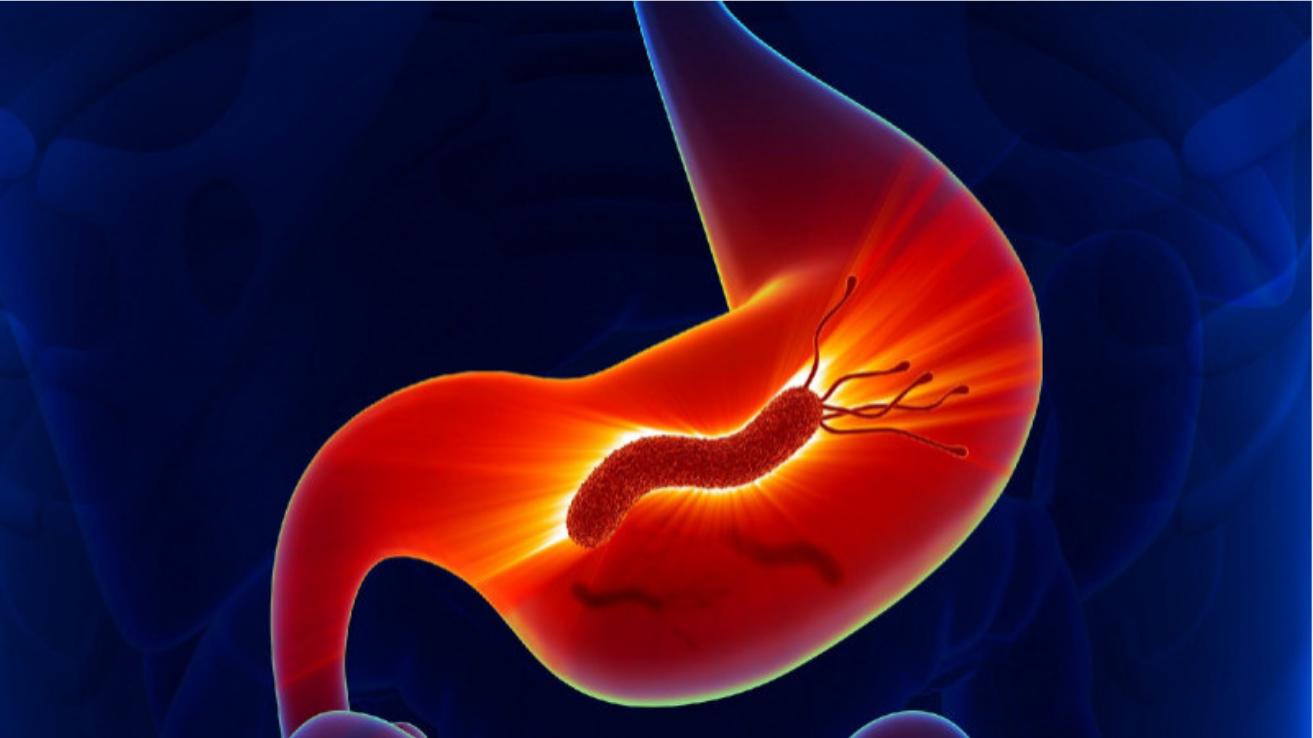 H. pylori infection and gastritis evaluation in Hyderabad
