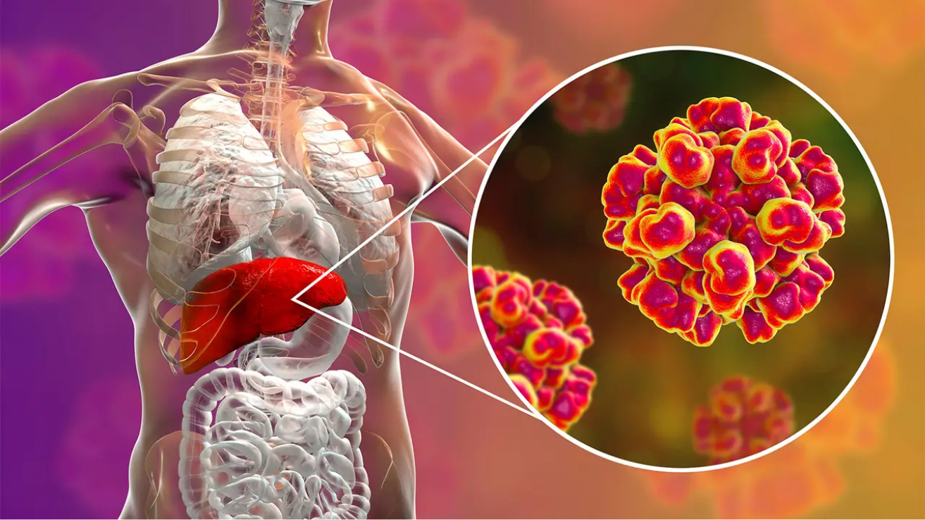 Hepatitis E liver infection evaluation in Hyderabad