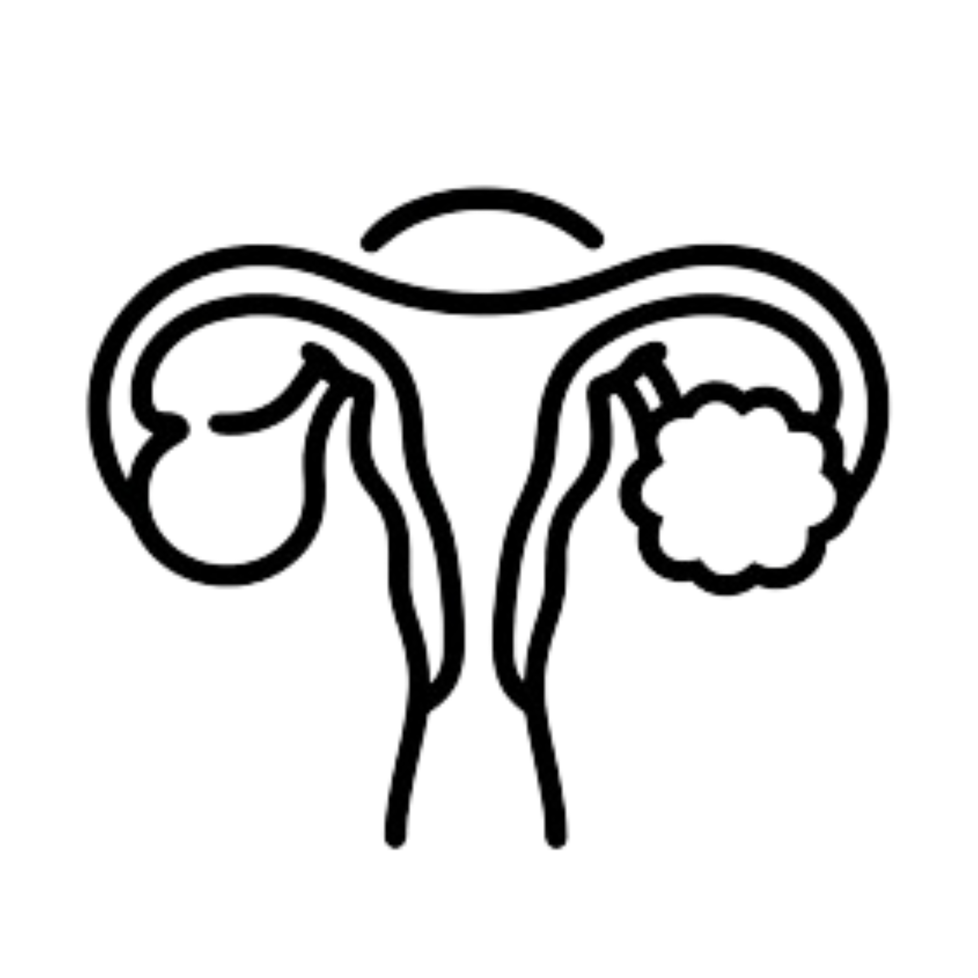 PCOS