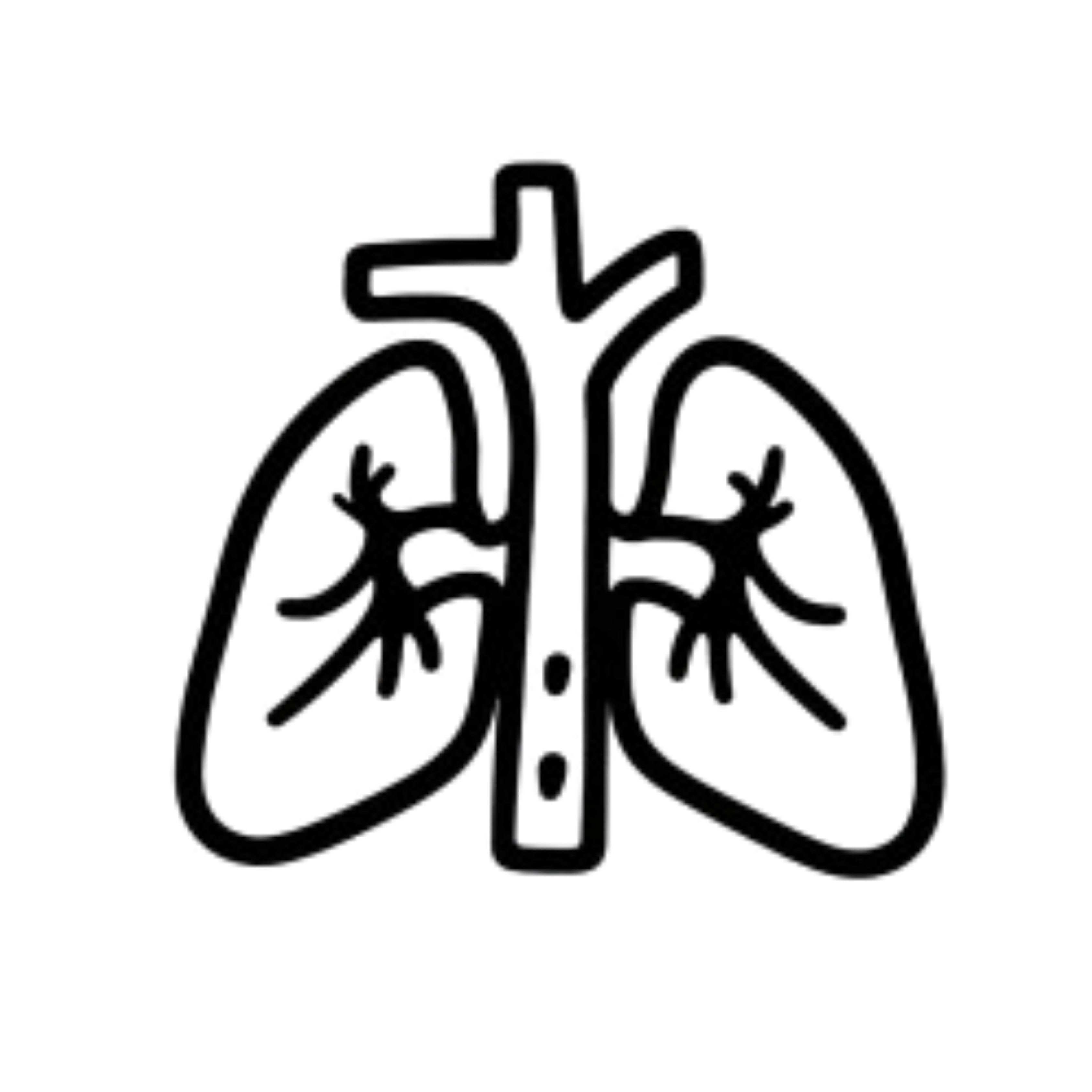 Pulmonary Embolism