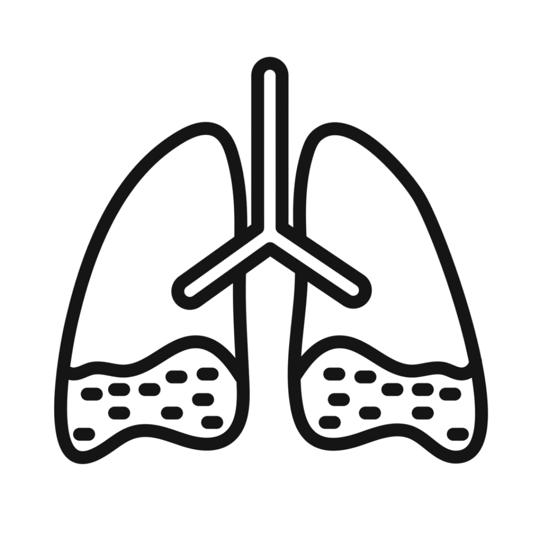 Asthma