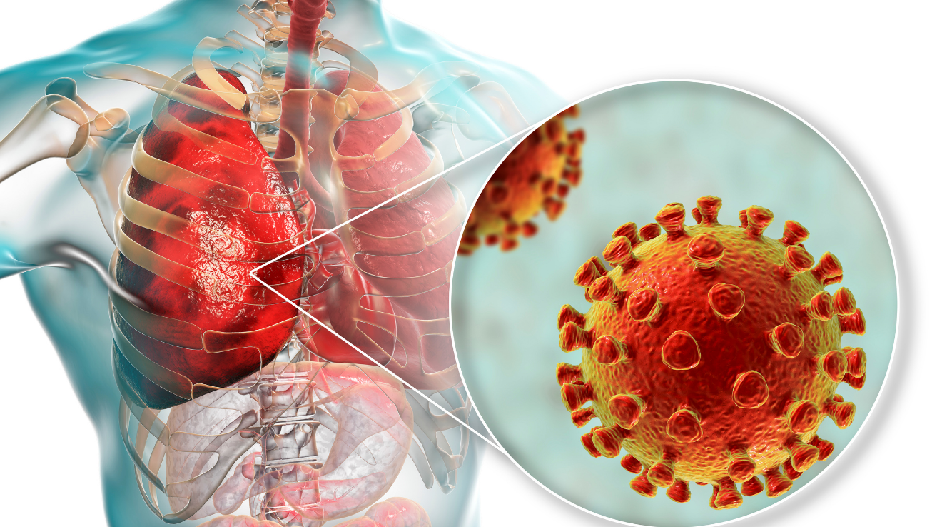 Pneumonia lung infection evaluation and care in Hyderabad