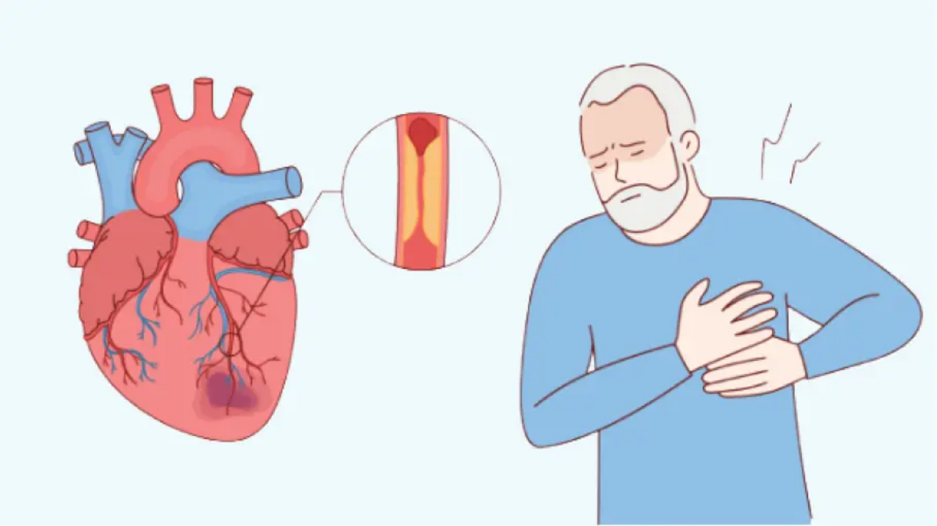 Palpitations heart flutter assessment and ECG in Hyderabad