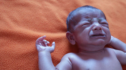 Methaemoglobinaemia assessment and treatment in Hyderabad