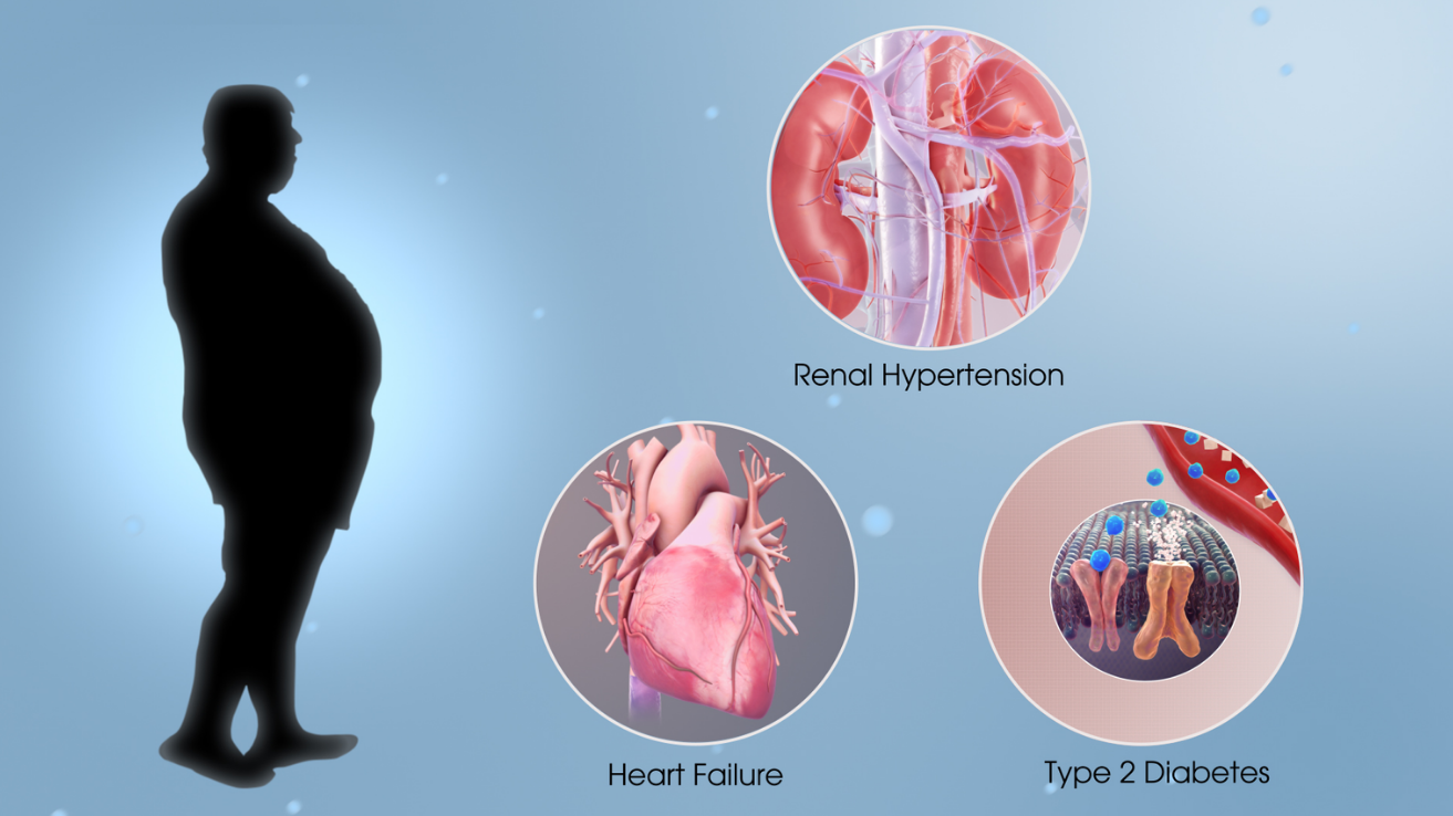 Metabolic syndrome and heart-risk evaluation in Hyderabad