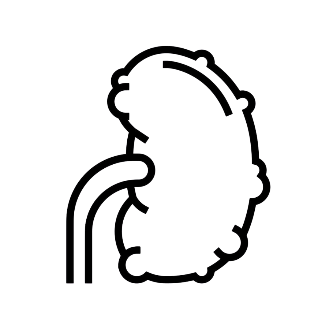 Pyelonephritis