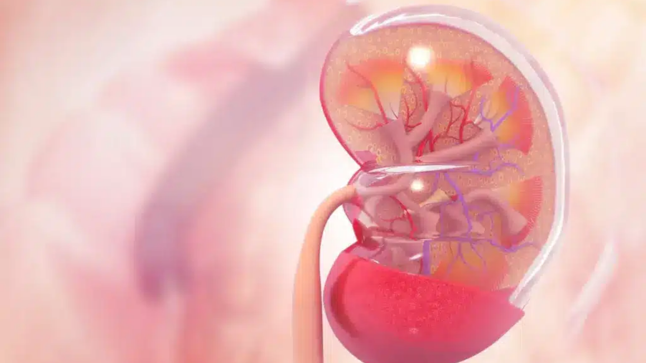 Nephritic syndrome evaluation and kidney care in Hyderabad