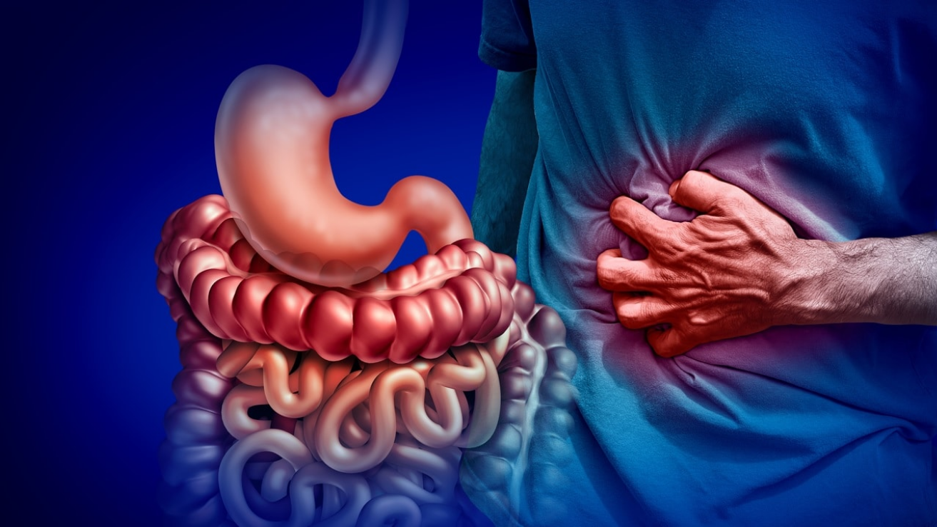 Crohn's disease bowel evaluation and care in Hyderabad