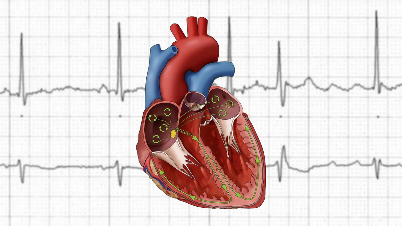 Atrial fibrillation (AFib) ECG check and care in Hyderabad