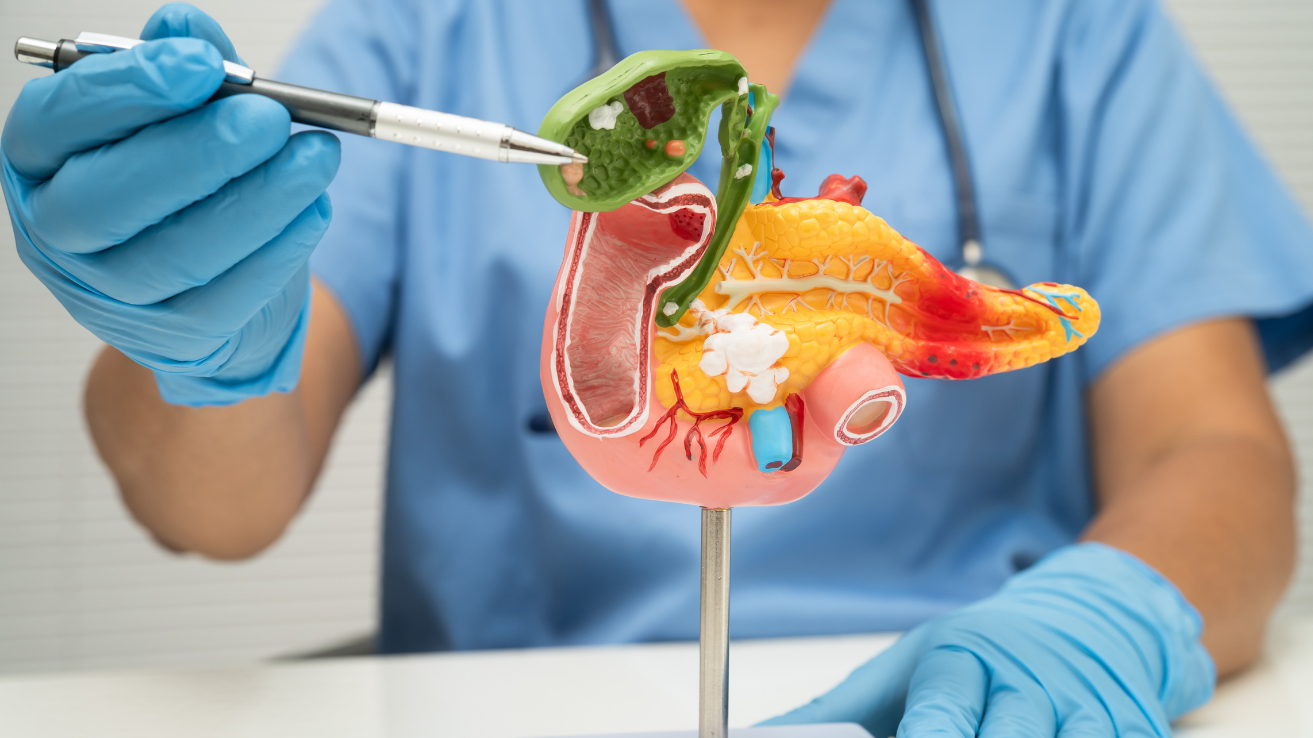 Gallstones ultrasound evaluation and care in Hyderabad