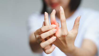 Rheumatoid arthritis joint evaluation and care in Hyderabad