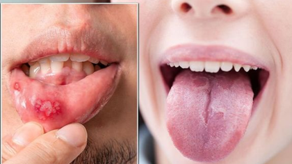 Folate deficiency blood test and treatment in Hyderabad
