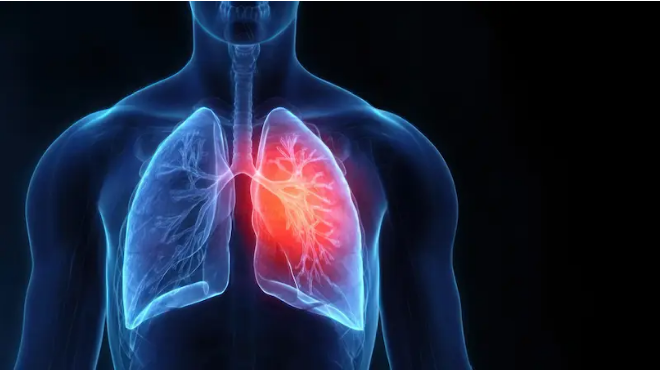 Upper respiratory infection (URTI) evaluation in Hyderabad