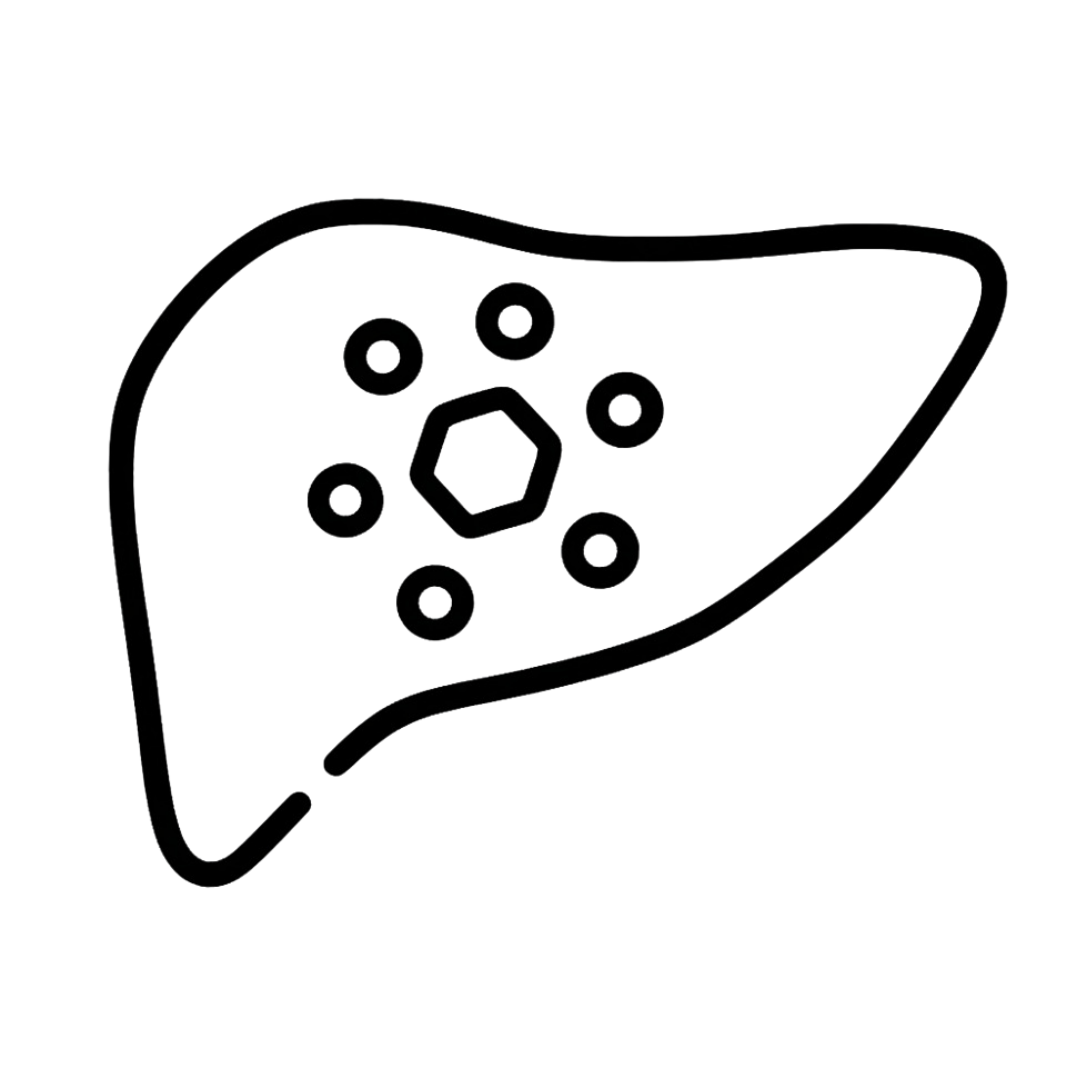 Wilson Disease