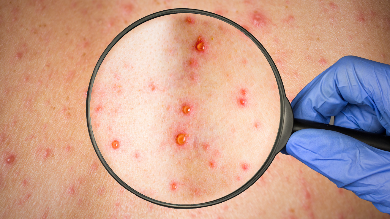 Rubella rash evaluation and pregnancy-risk care in Hyderabad