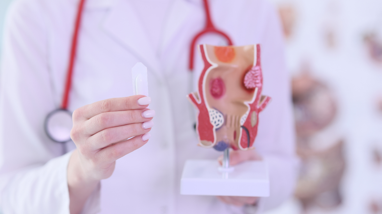 Hemorrhoids (piles) evaluation and treatment in Hyderabad