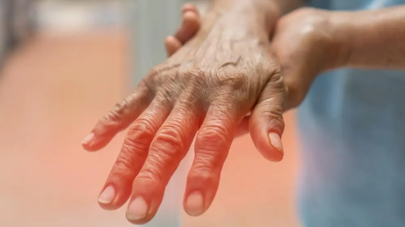 Peripheral neuropathy nerve evaluation in Hyderabad