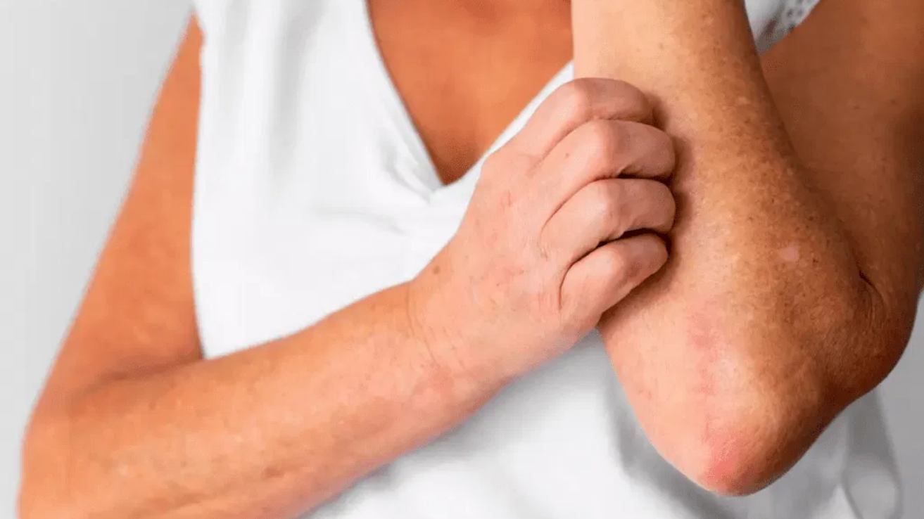 Polycythaemia (high RBC) evaluation and care in Hyderabad