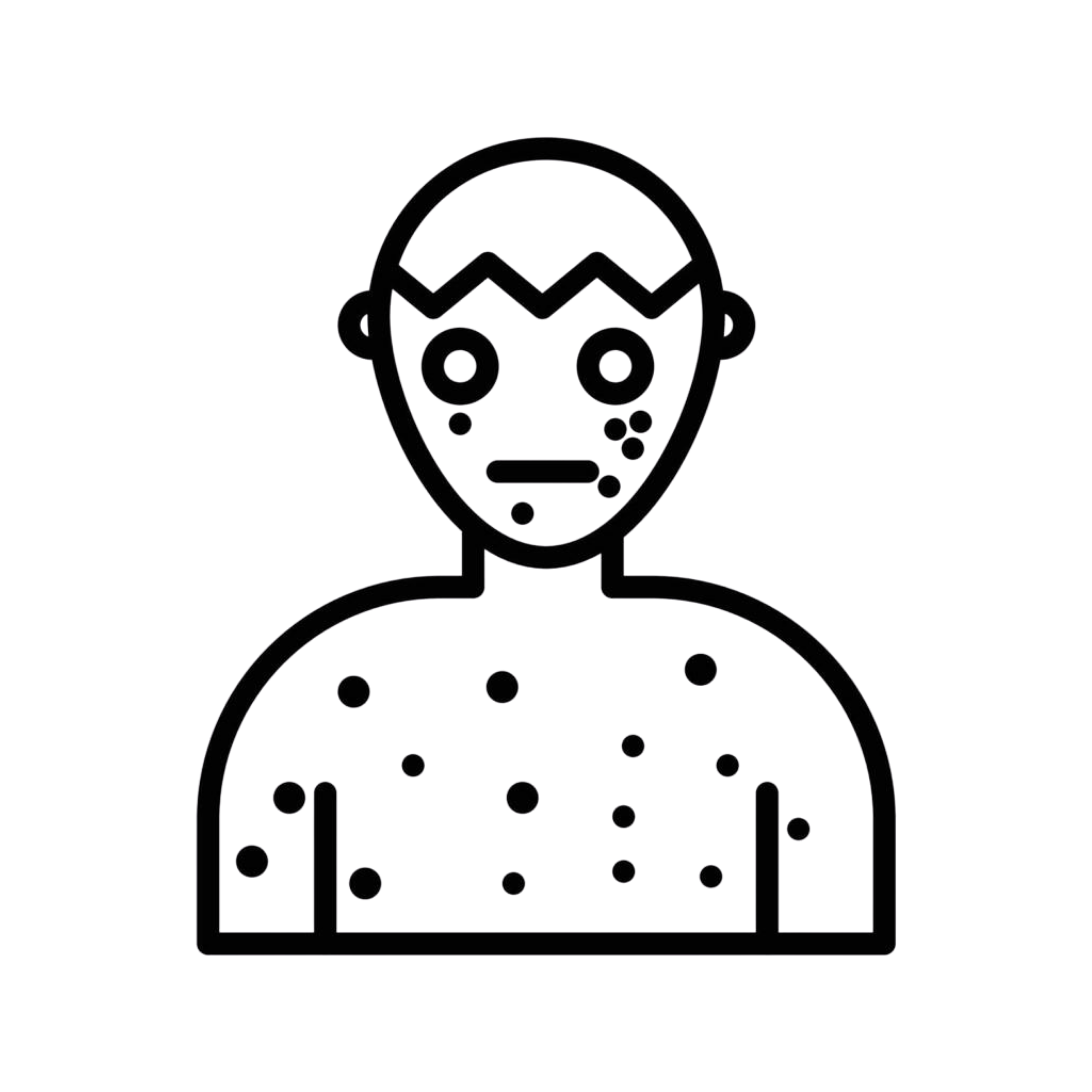 Chickenpox