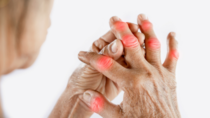 Psoriatic arthritis joint and skin evaluation in Hyderabad