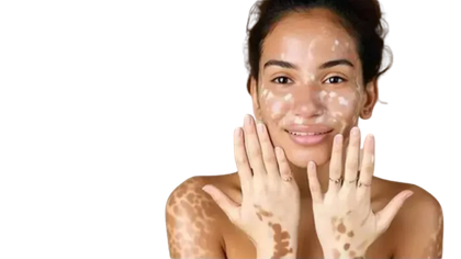 Vitamin B12 deficiency blood test and care in Hyderabad
