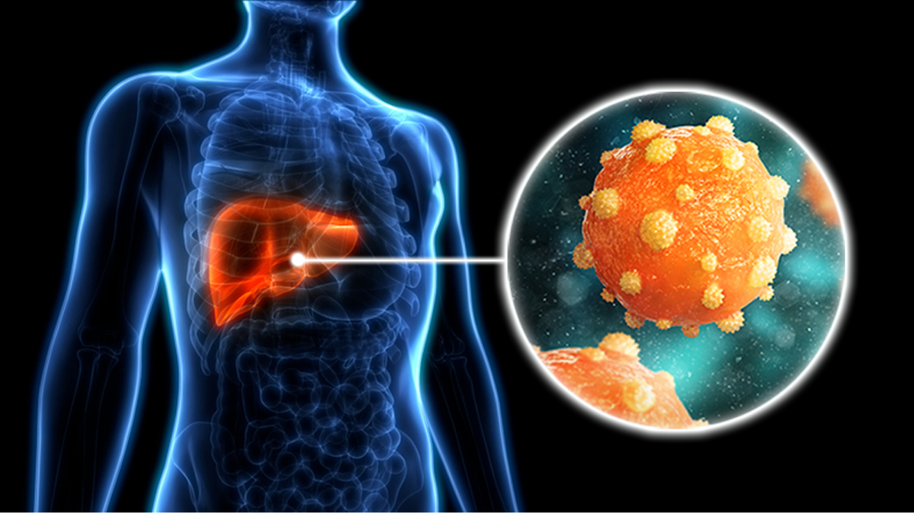 Hepatitis C liver infection evaluation in Hyderabad