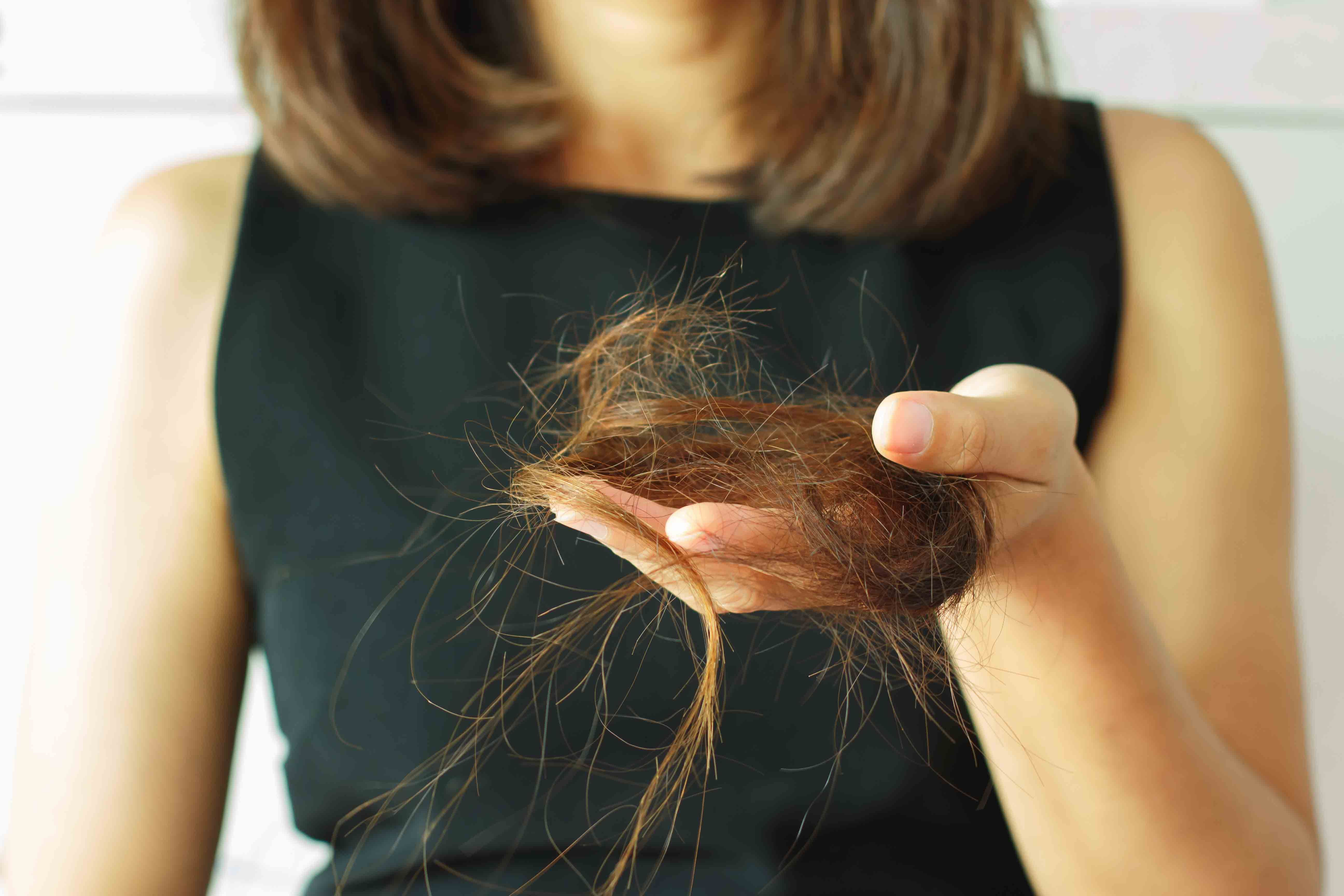 Сильно выпадают волосы причины и что делать. Сотное выпадение волос.