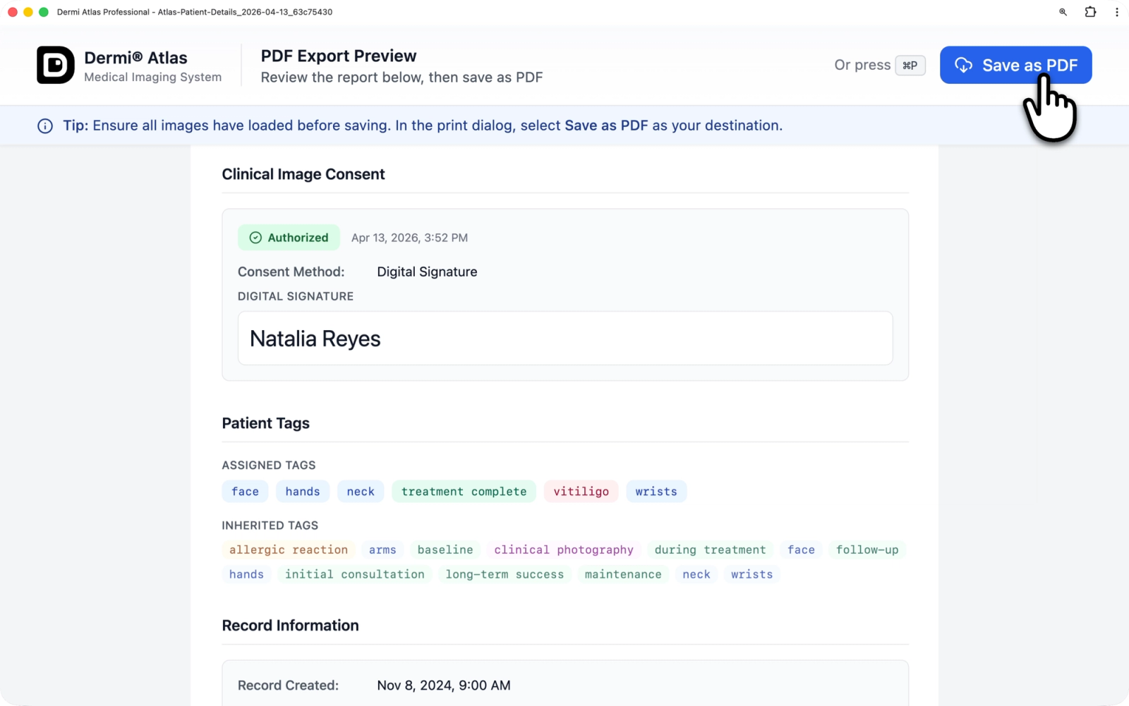 Clinical Image Consent section as it appears in an exported PDF report showing the authorization badge, method details, and timestamp