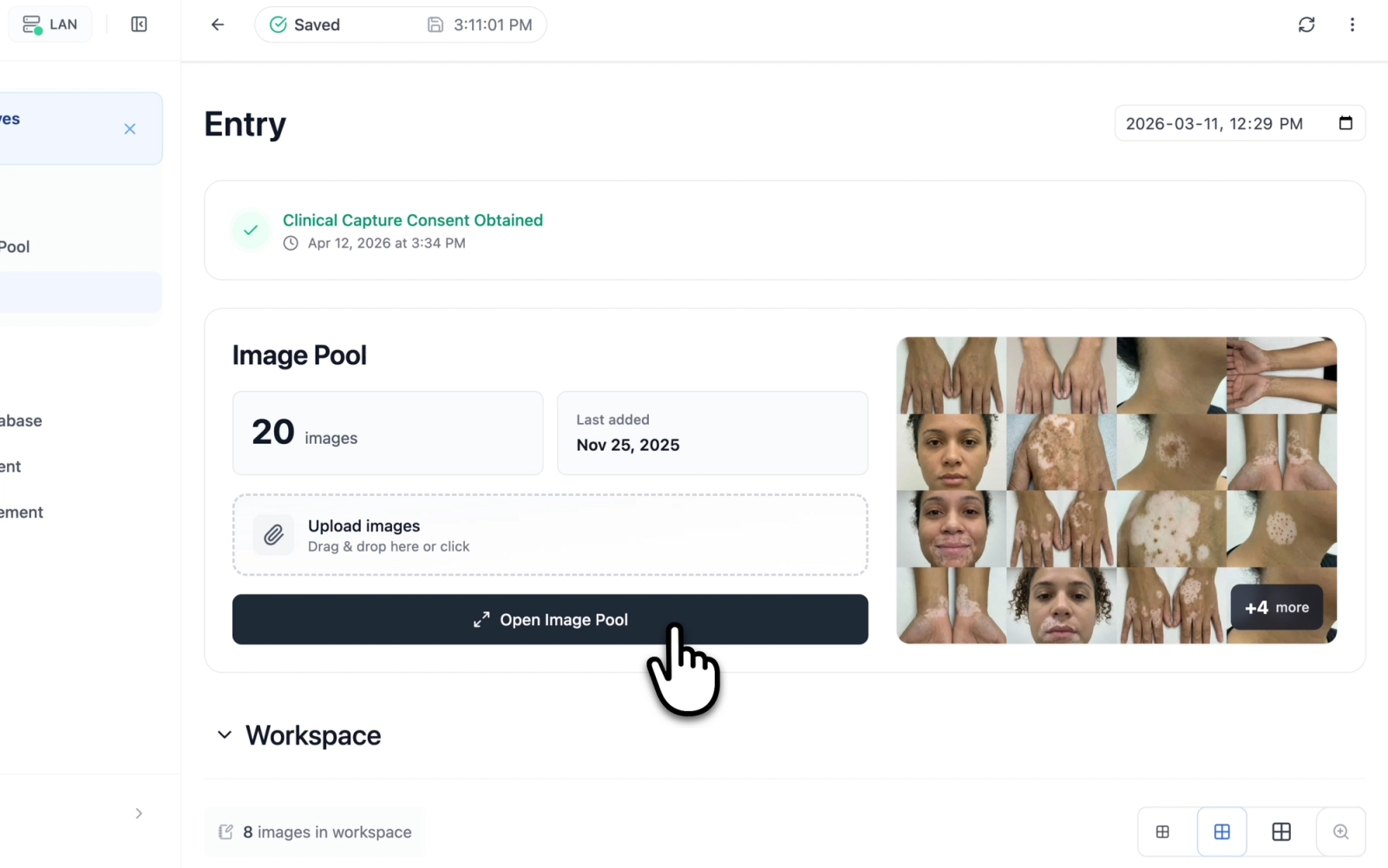 The Image Pool card within a Clinical Entry showing the image count, thumbnail preview grid, and the button to open the full pool view