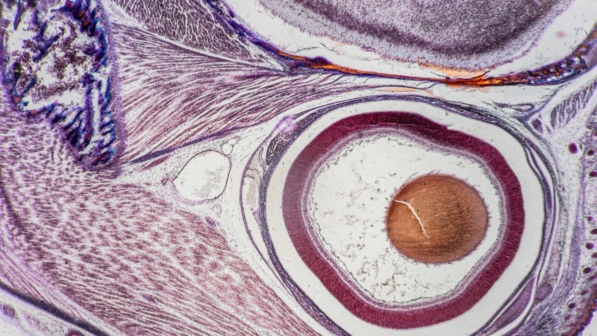 My egg freezing journey