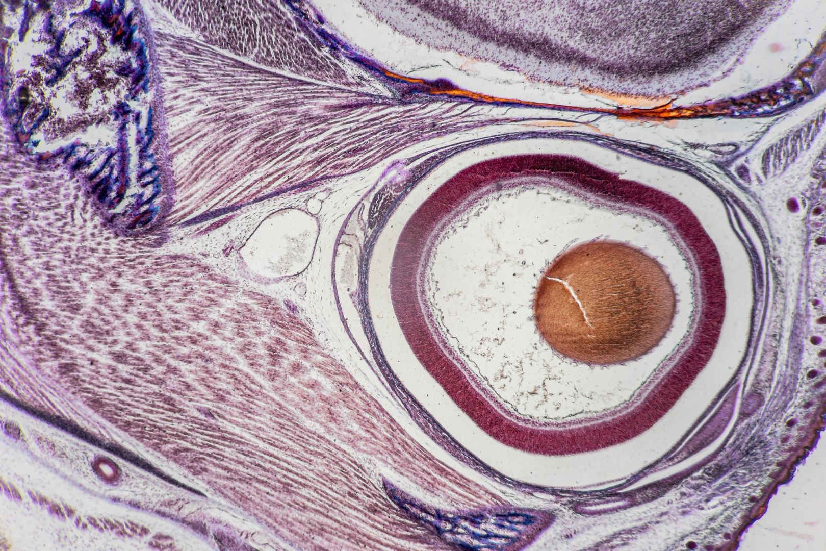 My egg freezing journey