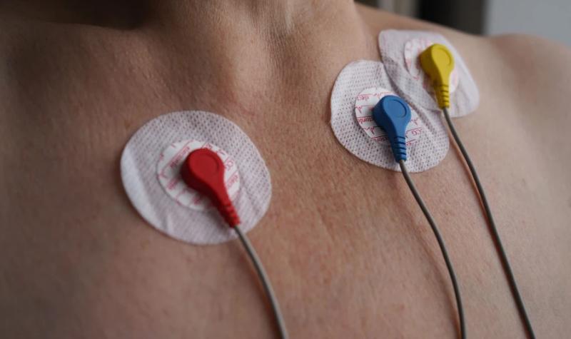 ECG電極の選択：B2B医療バイヤーにとっての重要な要素