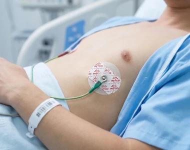 Non-woven ECG Electrode