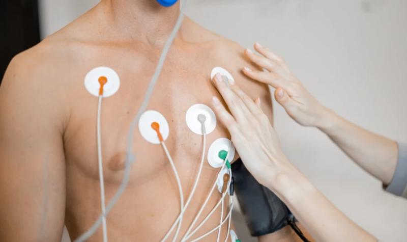 2025年に知っておきたいECG電極の配置