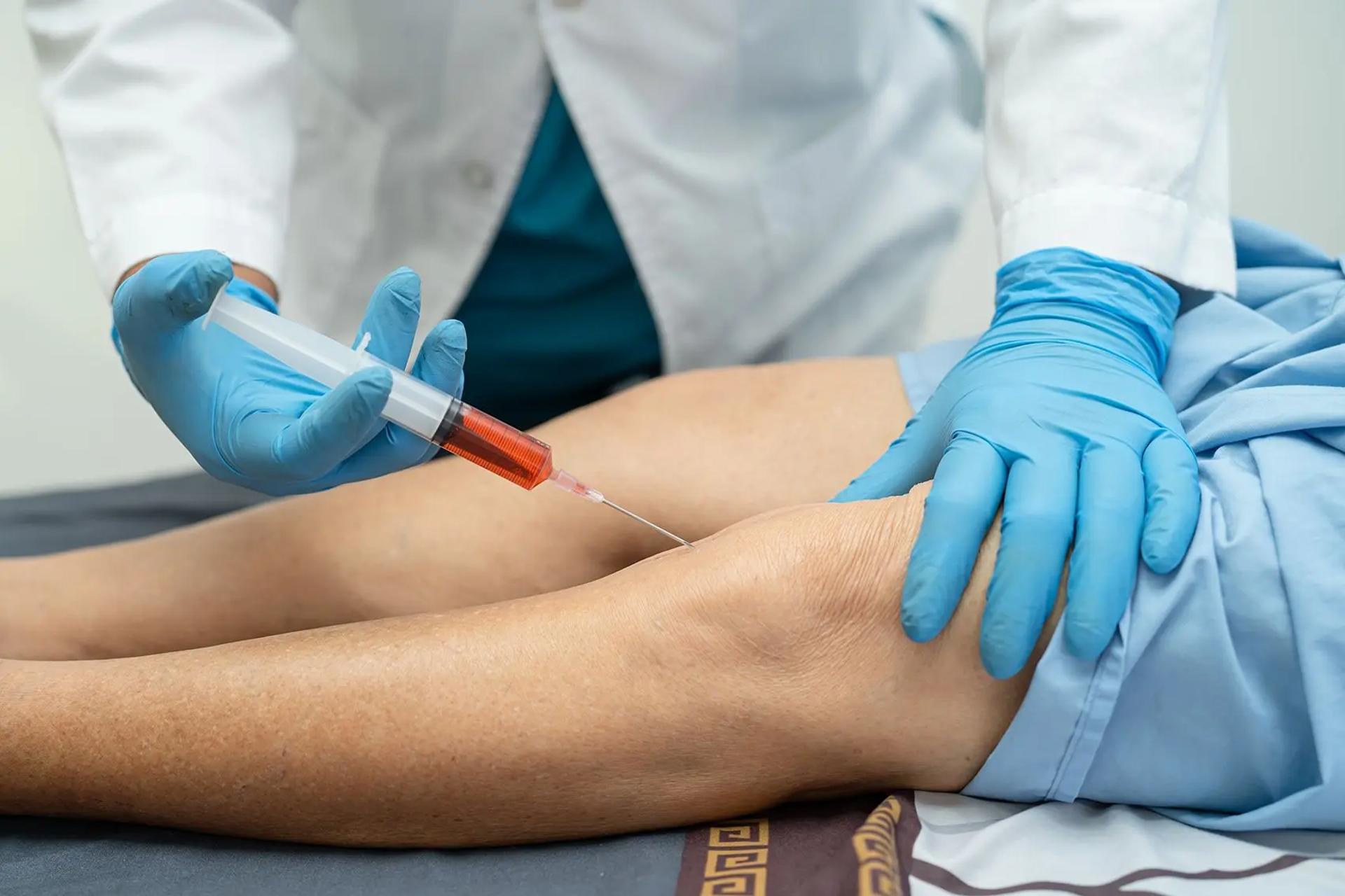 Prolotherapy