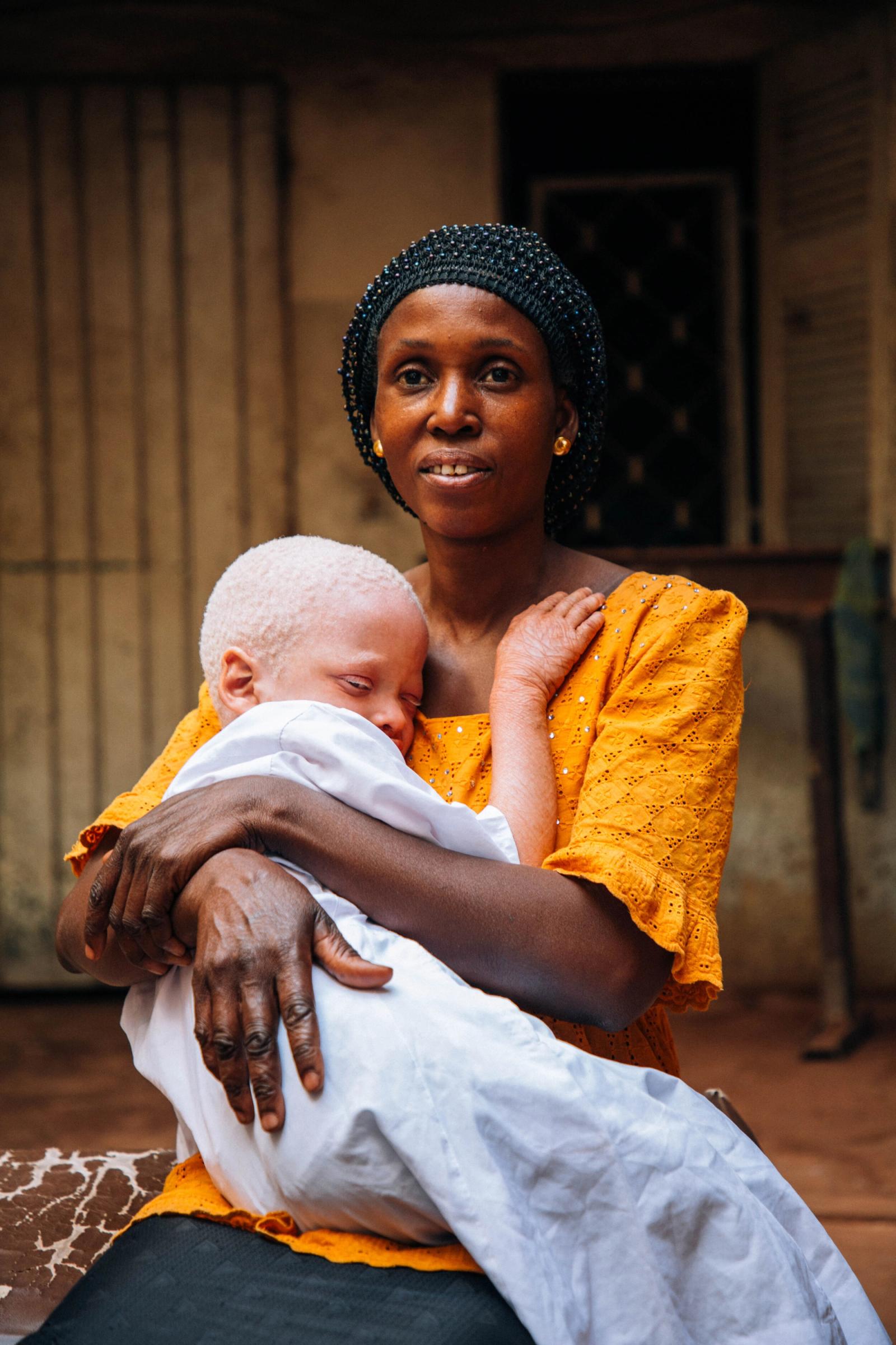 A woman in an orange blouse and black headwrap holds a baby with albinism wrapped in white, outside a wooden doorway.