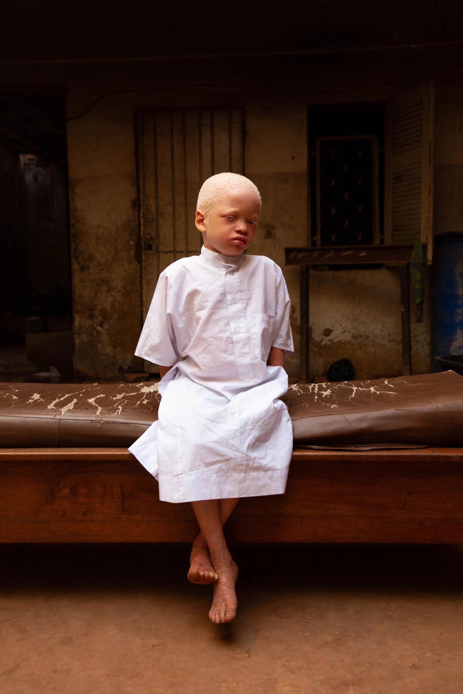 A child with albinism, in a white tunic, sits on a wooden bench with crossed feet in a dim doorway.