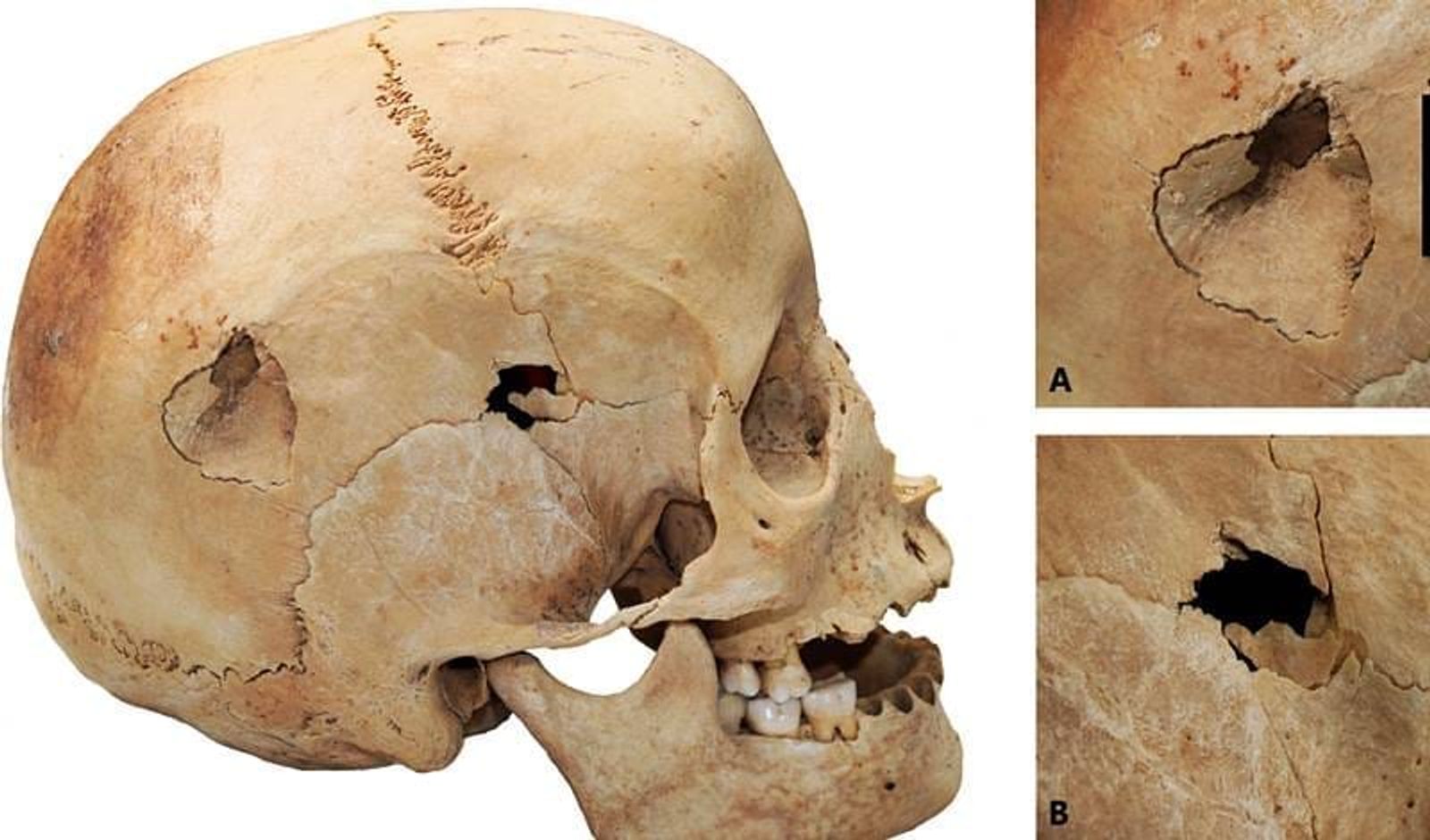 Nuevos hallazgos revelan asesinatos en Lanzarote hace más de 1.700 años