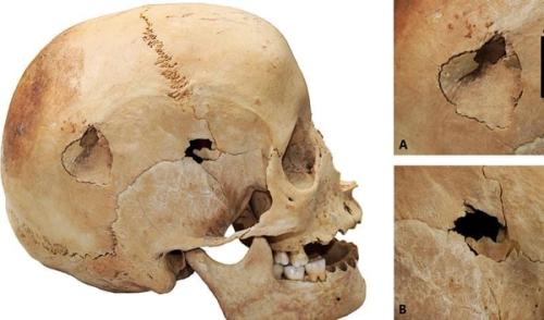 Nuevos hallazgos revelan asesinatos en Lanzarote hace más de 1.700 años