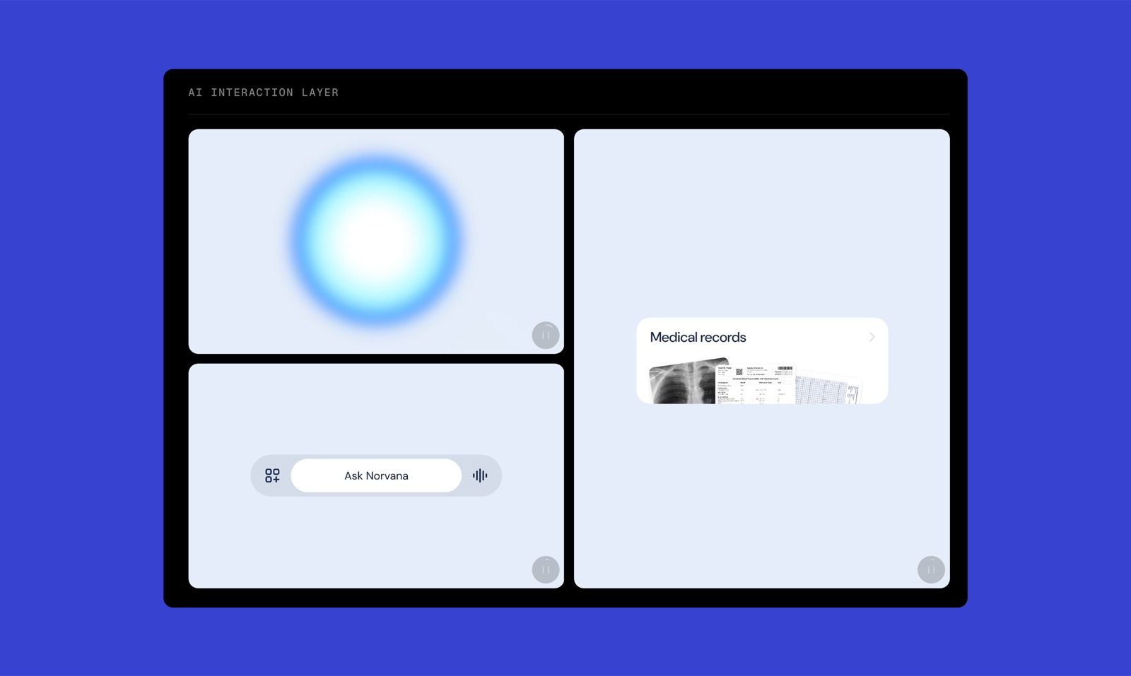 AI interaction layer in Norvana. Image credit: The Gradient
