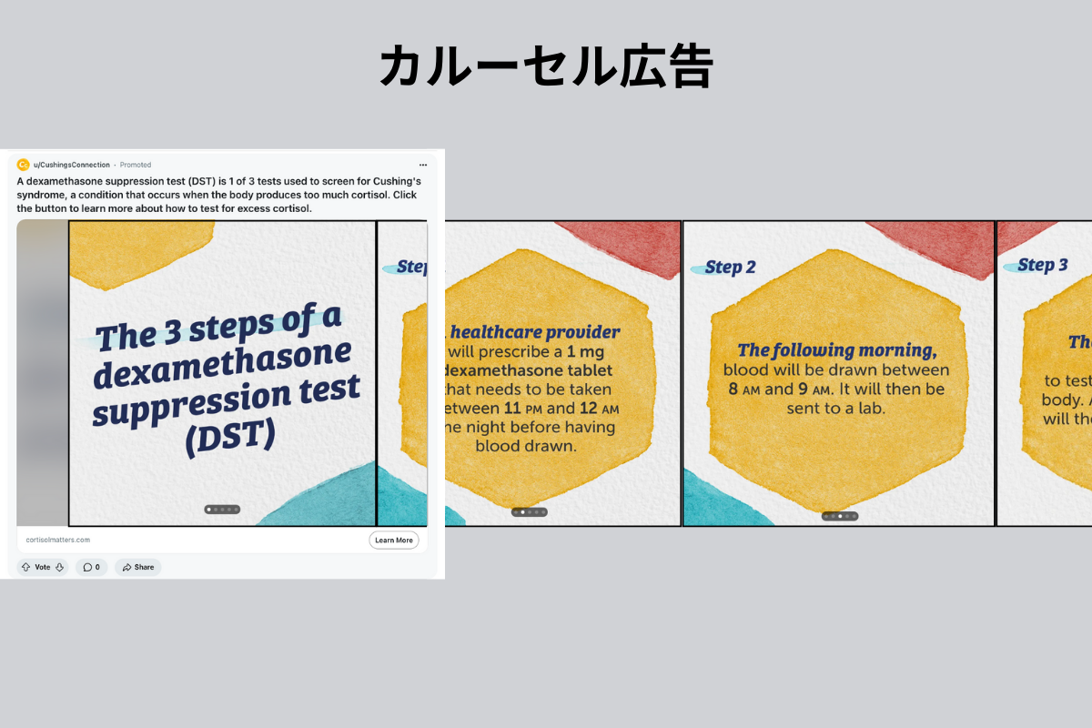 Reddit：カルーセル広告の例
