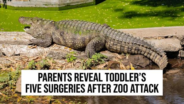 Boy, 3, Has Had Five Surgeries After Crocodile Attack