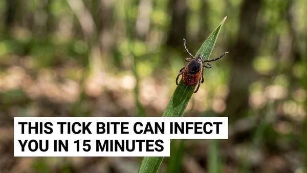 Rare Tick-Borne Virus Powassan Is Spreading Fast in the US