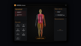 Personal status: every body zone shaded by how badly it is hurt, active conditions on the left, quick-access treatments below and a vague read on pulse and blood
